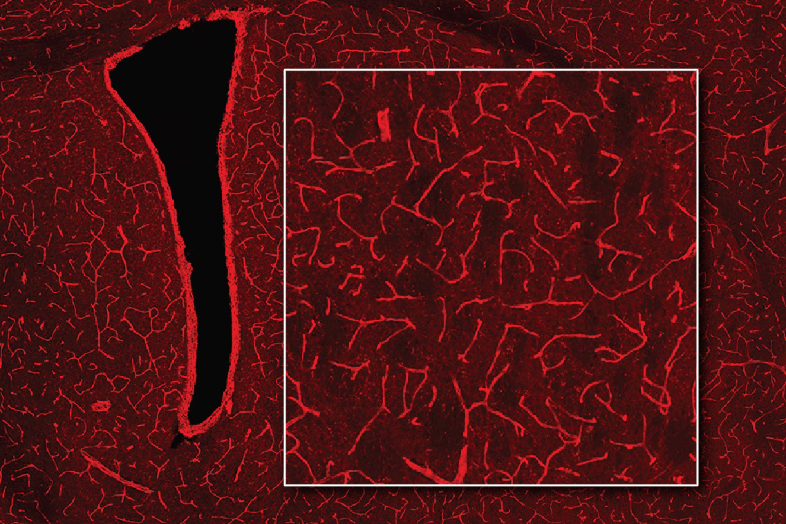 A microscopic image showing a network of thin, red branching vessels on a dark background, with a magnified inset highlighting the intricate web-like structure of the vessels.